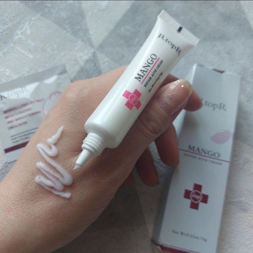 Acne Treatment Face Cream Blackhead Repair Gel Oil Control Shrink Pores Scar Whitening Moisturizer photo review