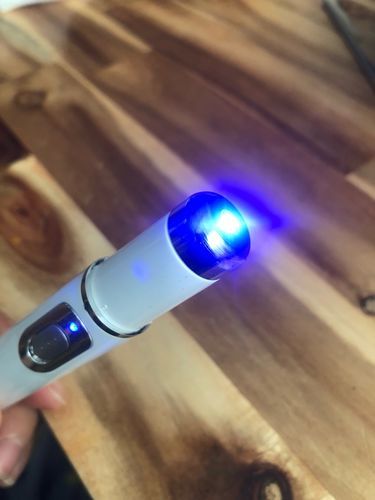 Blue Light Therapy Pen for Spider Vein Treatment photo review