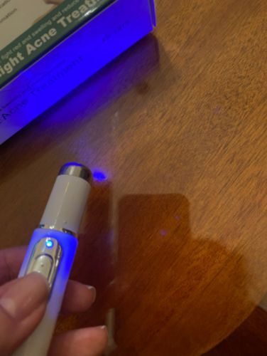 Bluelight Therapy Pen For Varicose Veins photo review