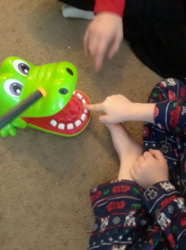 Game Crocodile Dentist - Crocodile Teeth Game photo review