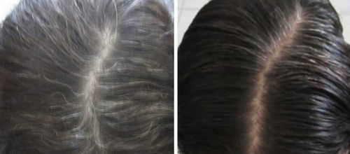 Grey Reverse Hair Darkening Shampoo photo review
