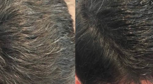 Grey Reverse Hair Darkening Shampoo photo review