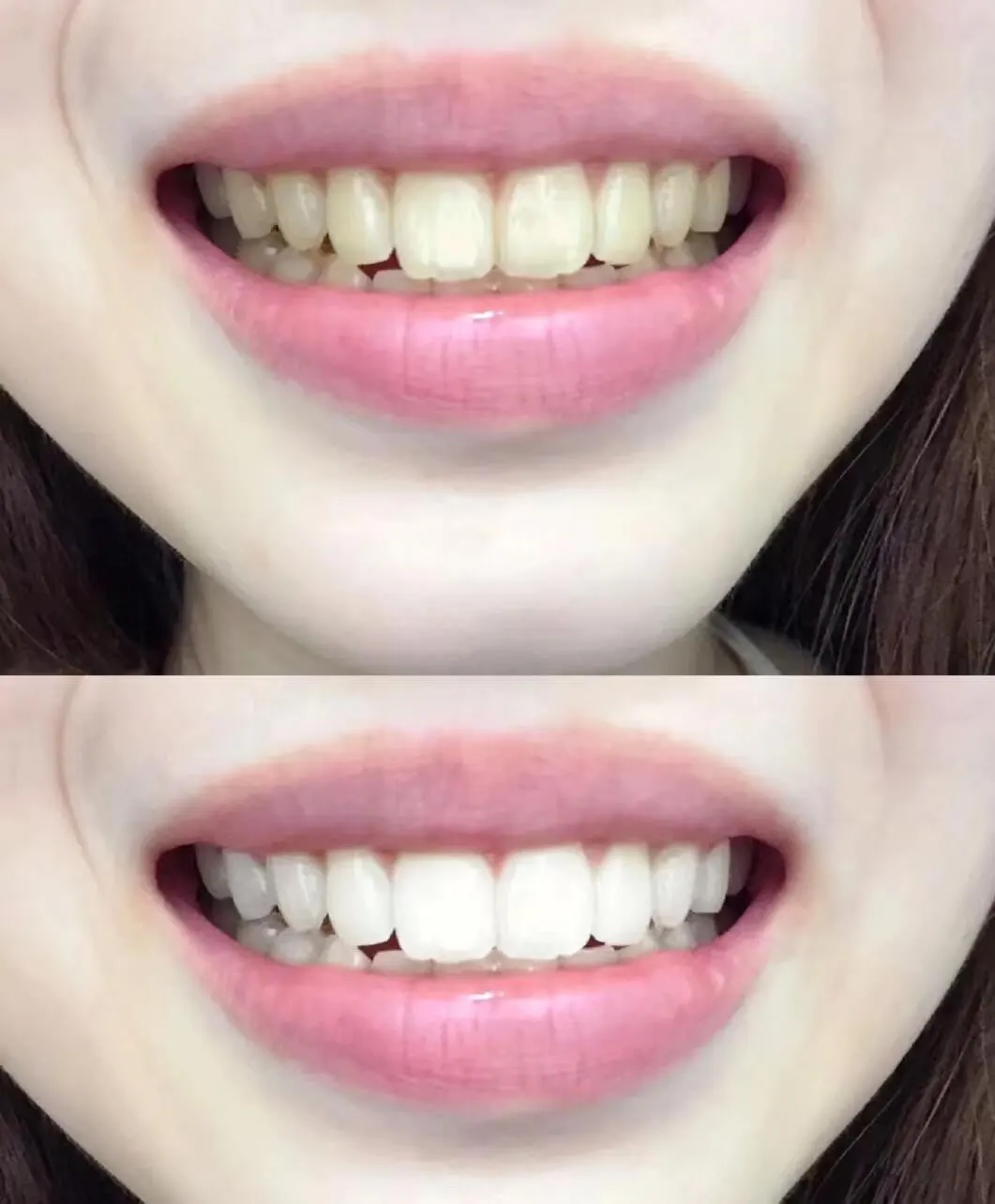 Intensive Stain Removal Whitening Toothpaste photo review