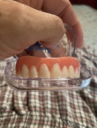 Snap On Dentures Perfect Smile photo review