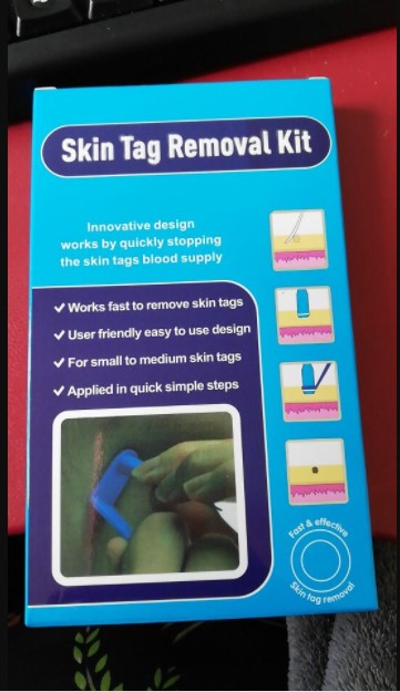 Skin Tag Removal Kit photo review