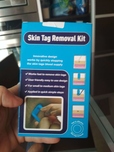 Skin Tag Removal Kit photo review